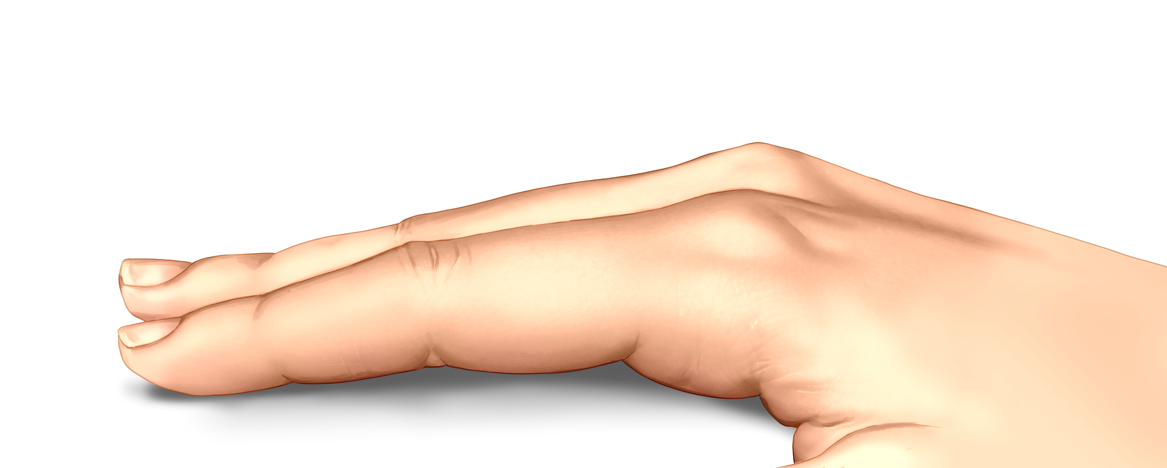  The base hand used for the figure 