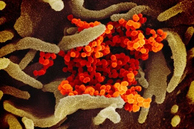Researchers identify cells likely targeted by Covid-19 virus