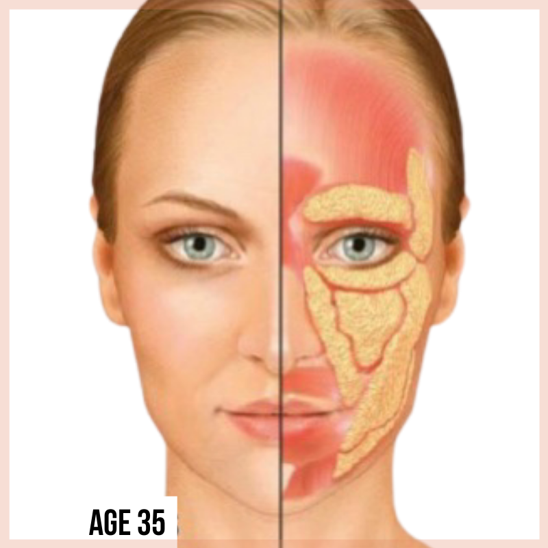 Preventing Facial Aging Dr Katie Beleznay