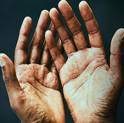 Hands Thumbnail for Website Sq.png