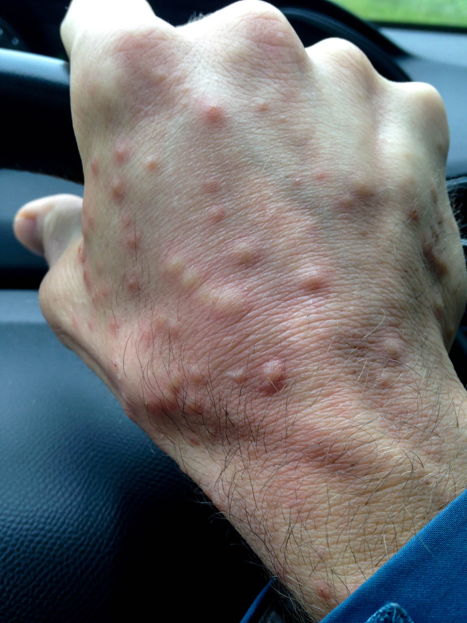 Tom's Mosquito Hand