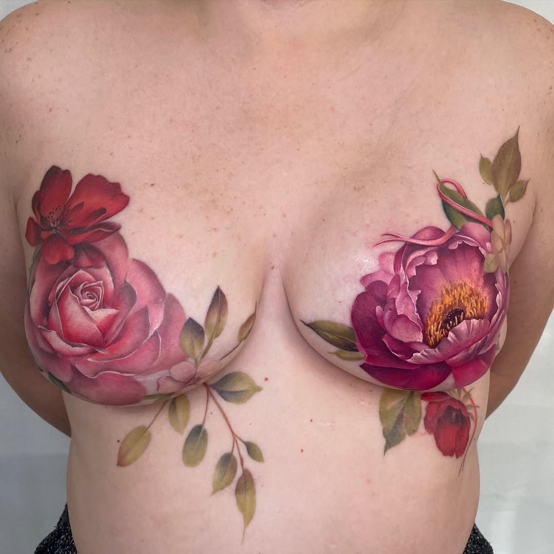 Mastectomy.jpeg