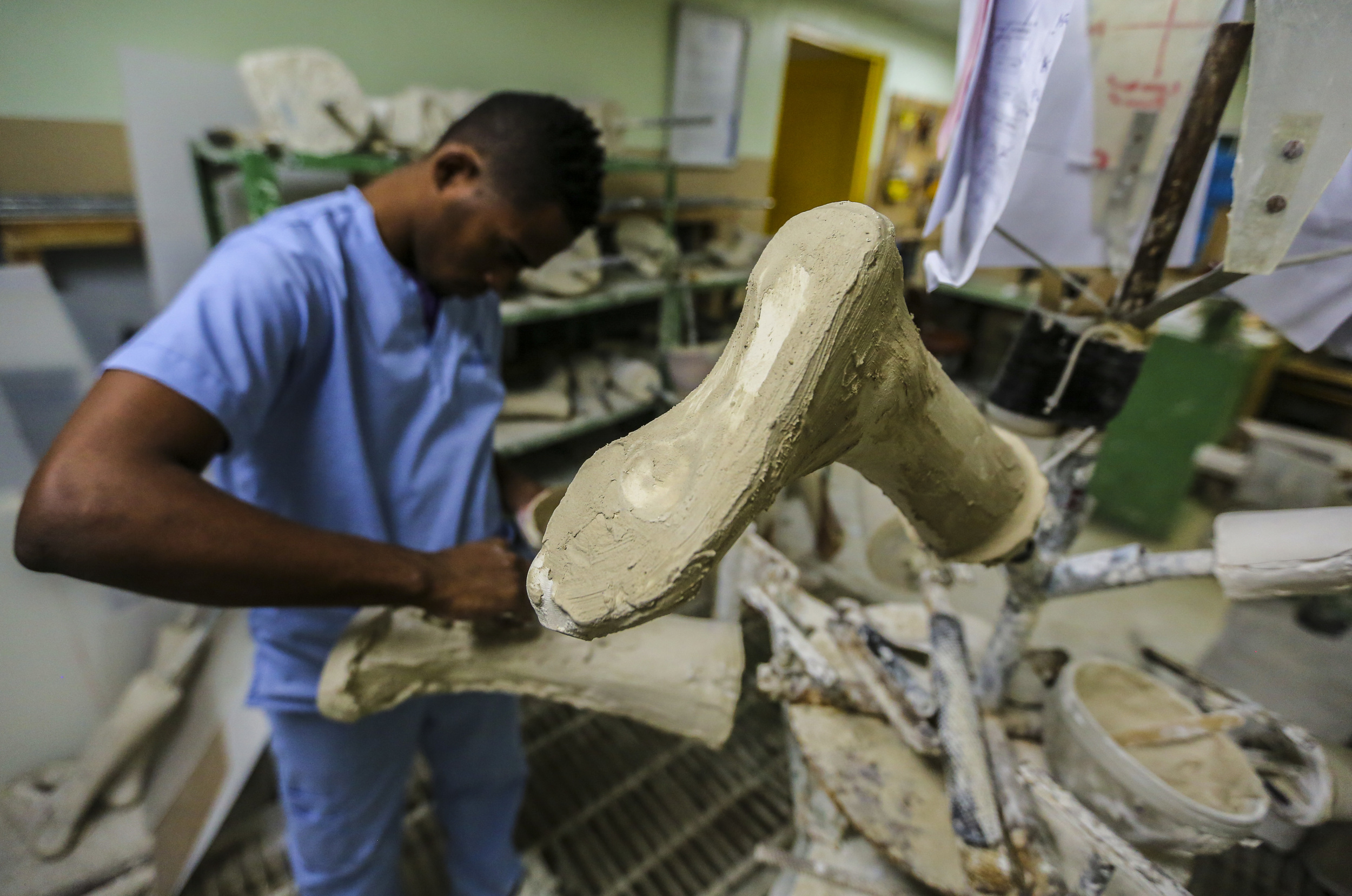  Crafting molds for amputees in Santo Domingo, Dominican Republic. 