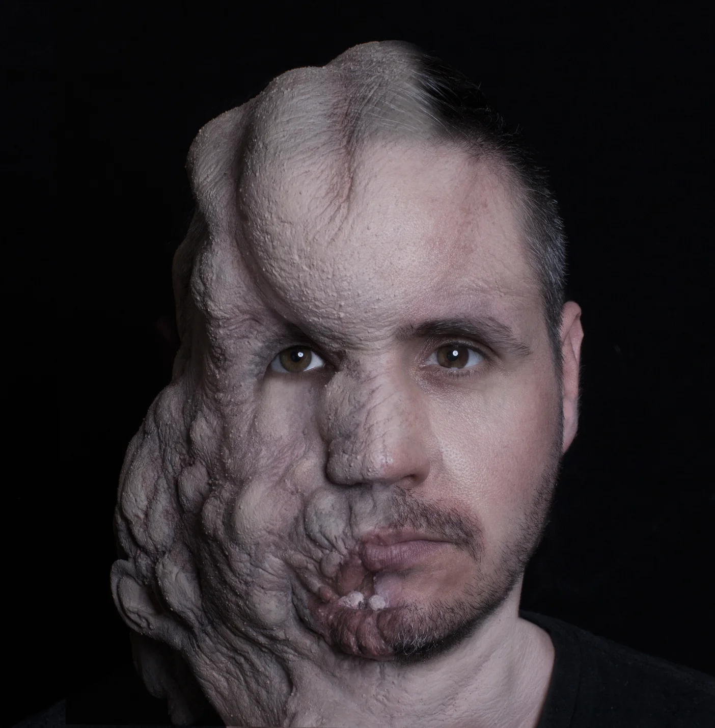 The Elephant Man