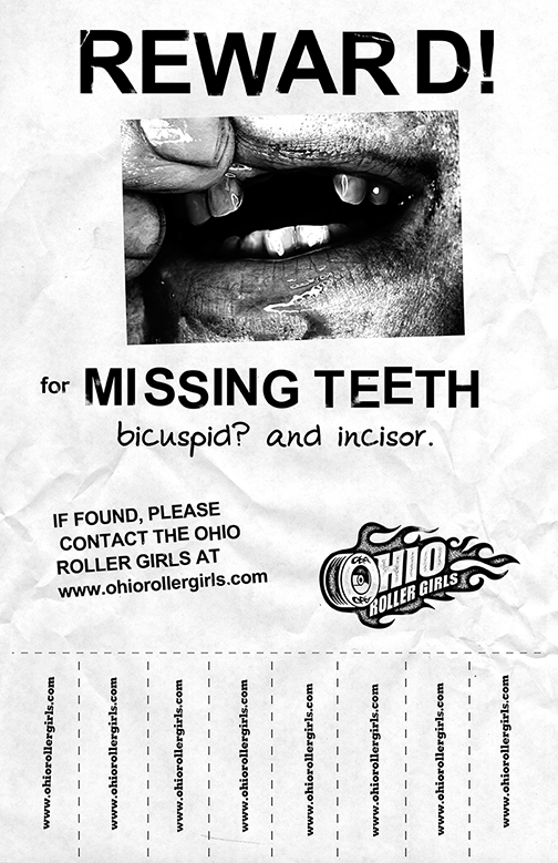 missing_teeth.png