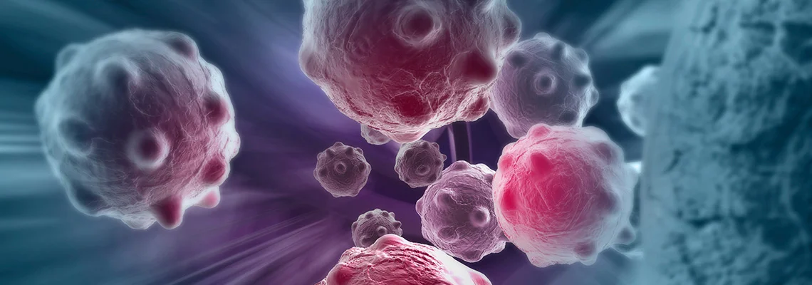 4850_Cancer_banner_1140x400_New.jpg