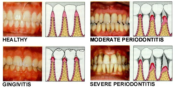 perioproblem.jpg