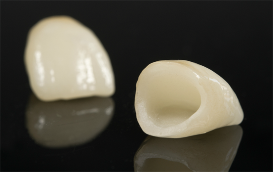 All ceramic option, does not have a metal base. Recommended for best cosmetic result.