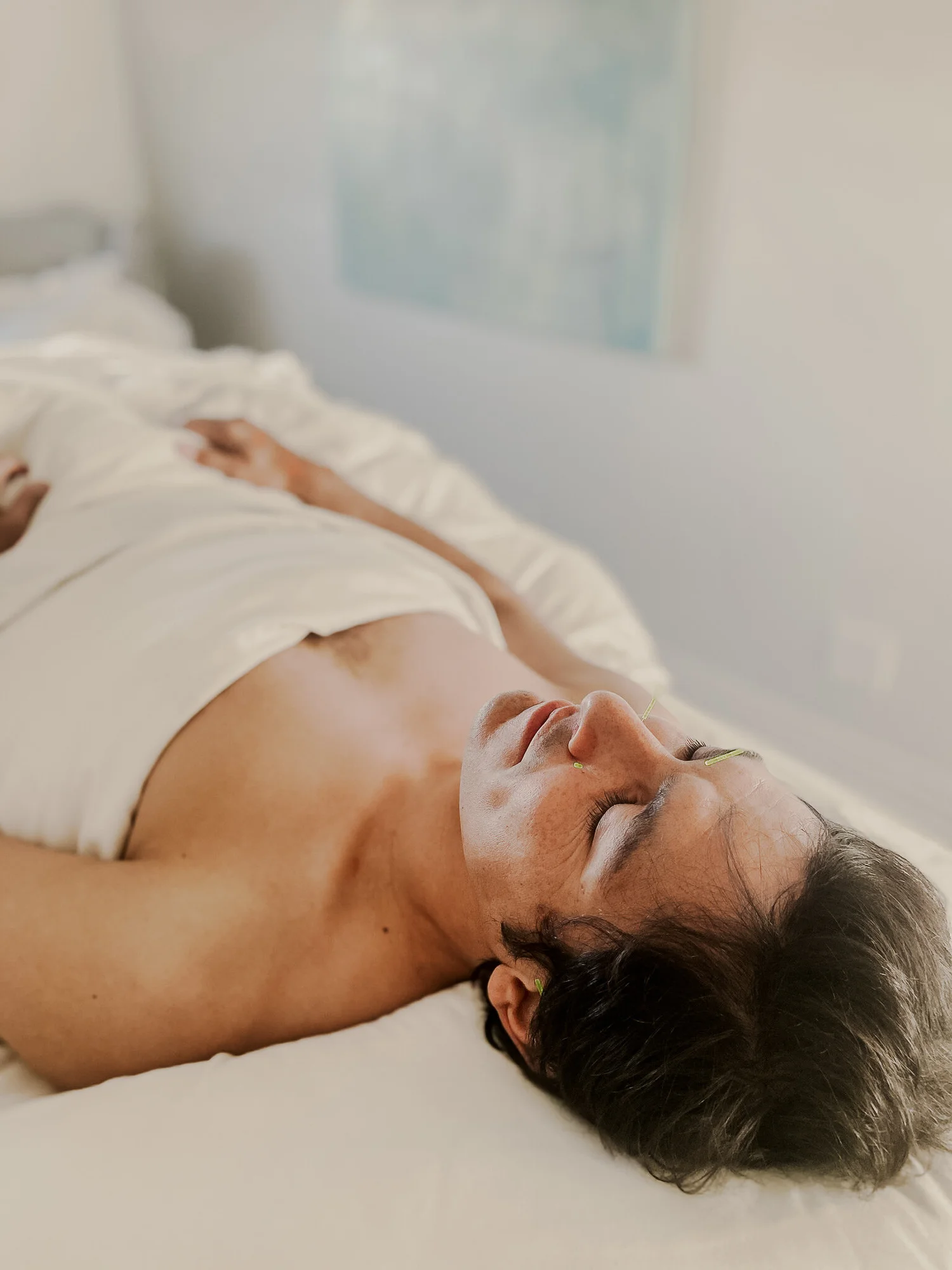 A client resting calmly on the treatment table during acupuncture at Saffron & Sage