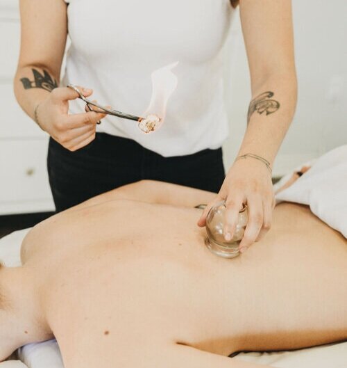 Fire cupping treatment at Saffron & Sage