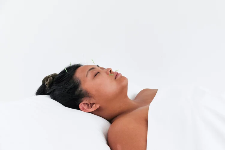 Facial acupuncture at Saffron & Sage in San Diego