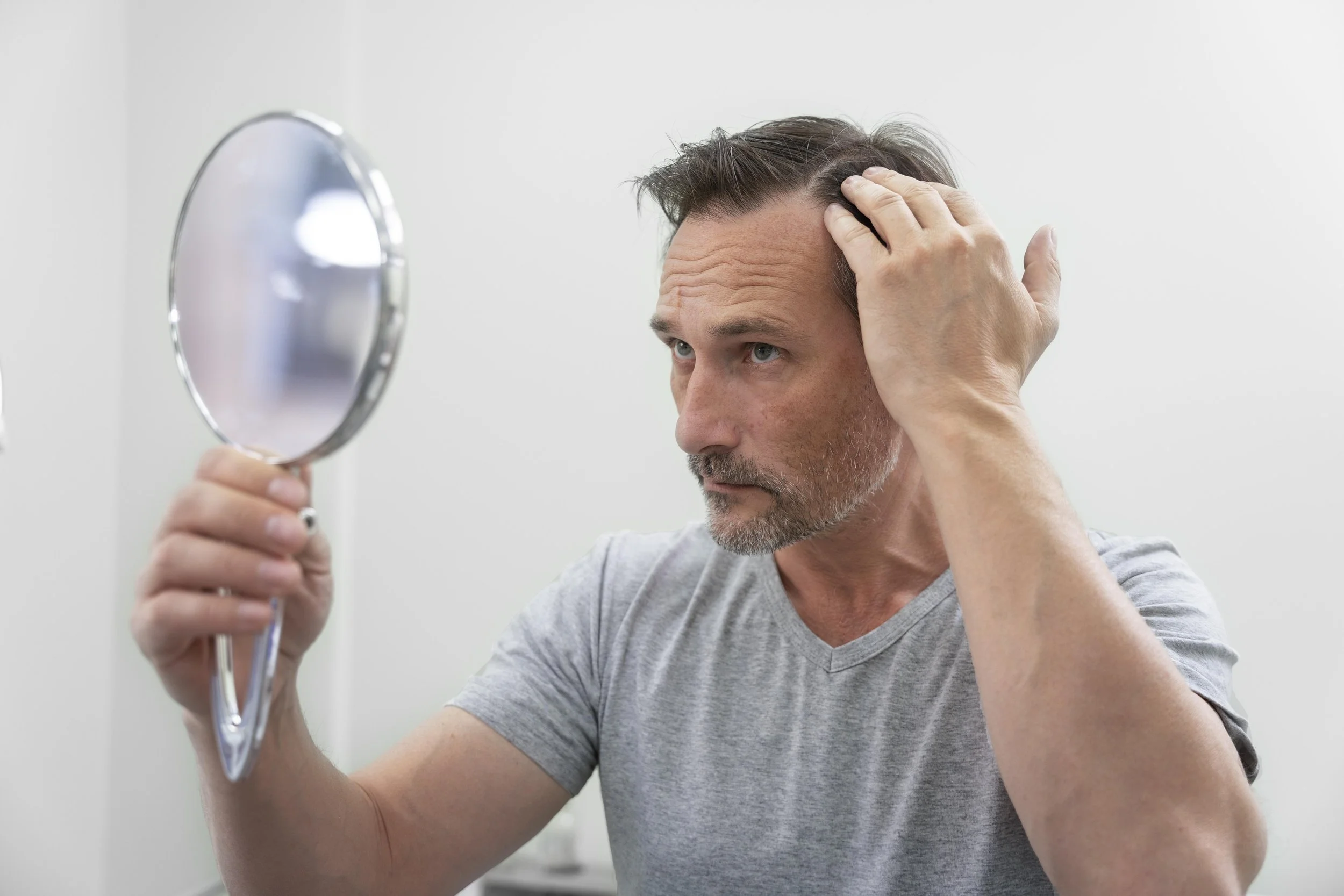 Understanding Hair Loss: A Widespread Concern