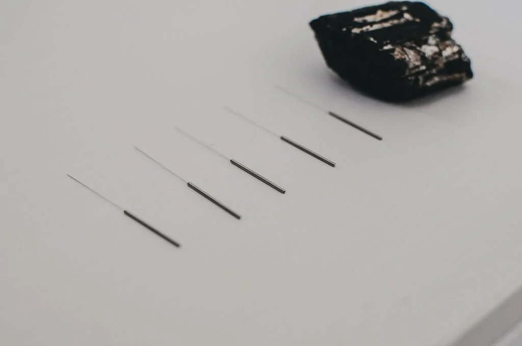 How Acupuncture Can Support Your Weight Loss Journey