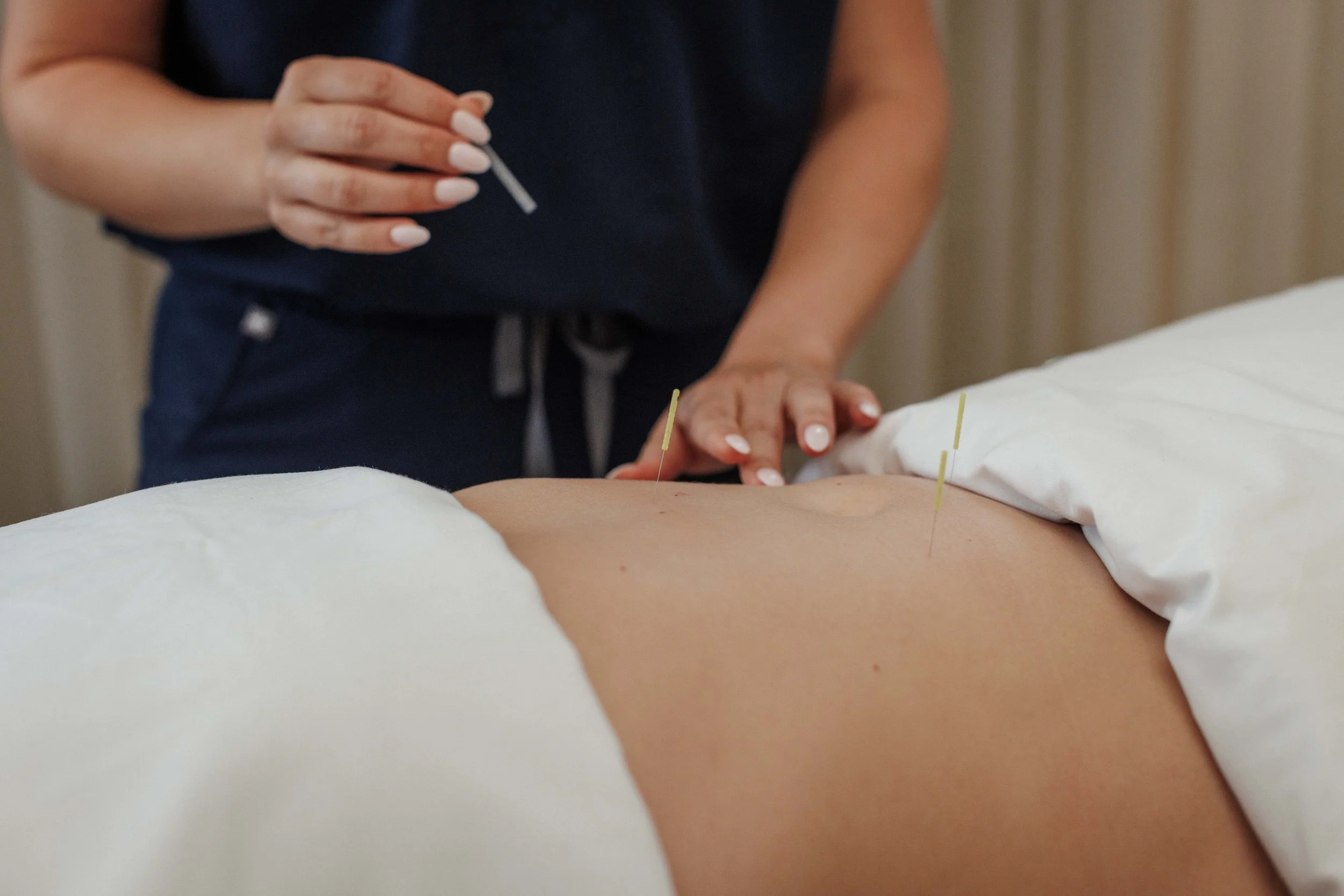 How Acupuncture Supports Mental Health, Nervous System Regulation, and Emotional Wellbeing