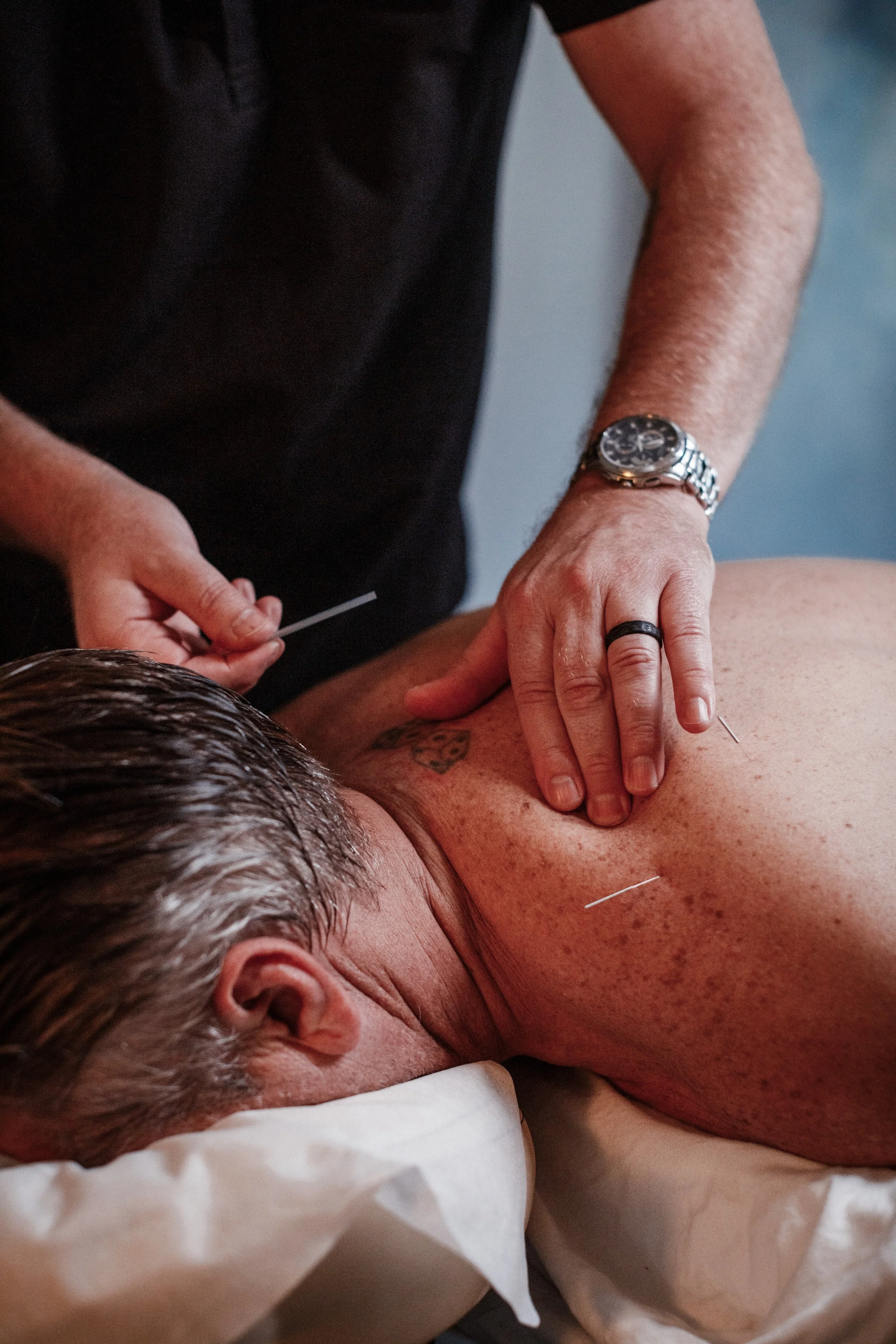 Trigger Point Acupuncture: A Targeted Approach to Muscle Tension, Pain, and Recovery