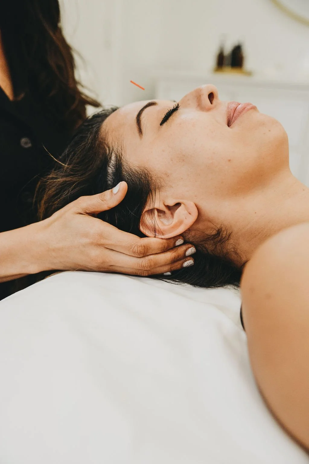 Prenatal Acupuncture: Gentle Support for Every Trimester