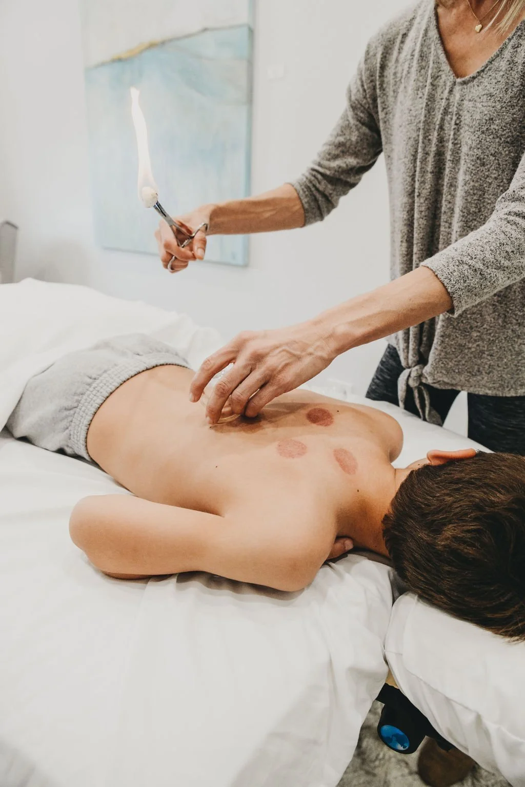 Peak Performance Acupuncture: Recovery, Focus and Resilience for Athletes and High Performers