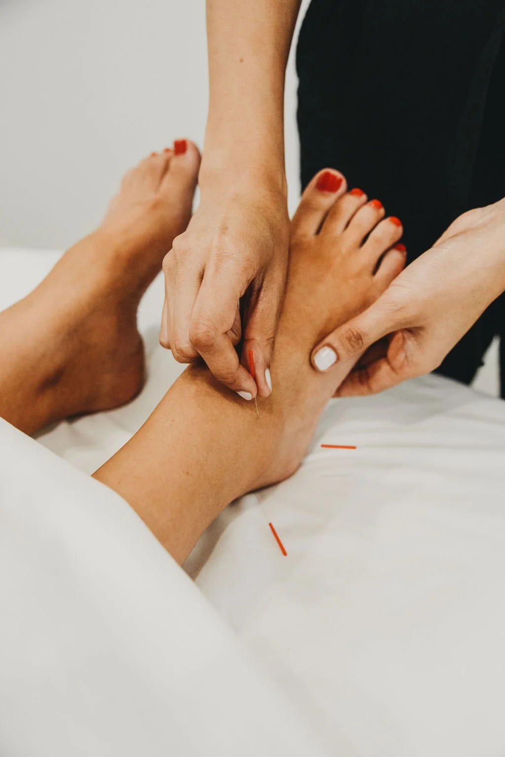 Acupuncture for Immunity and Travel: Staying Well Before, During and After a Trip