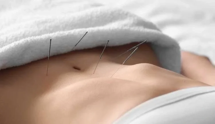 Fertility acupuncture at Saffron & Sage