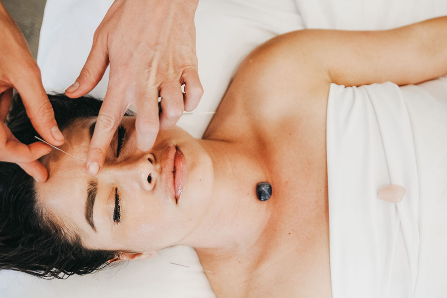 traditional acupuncture in san diego