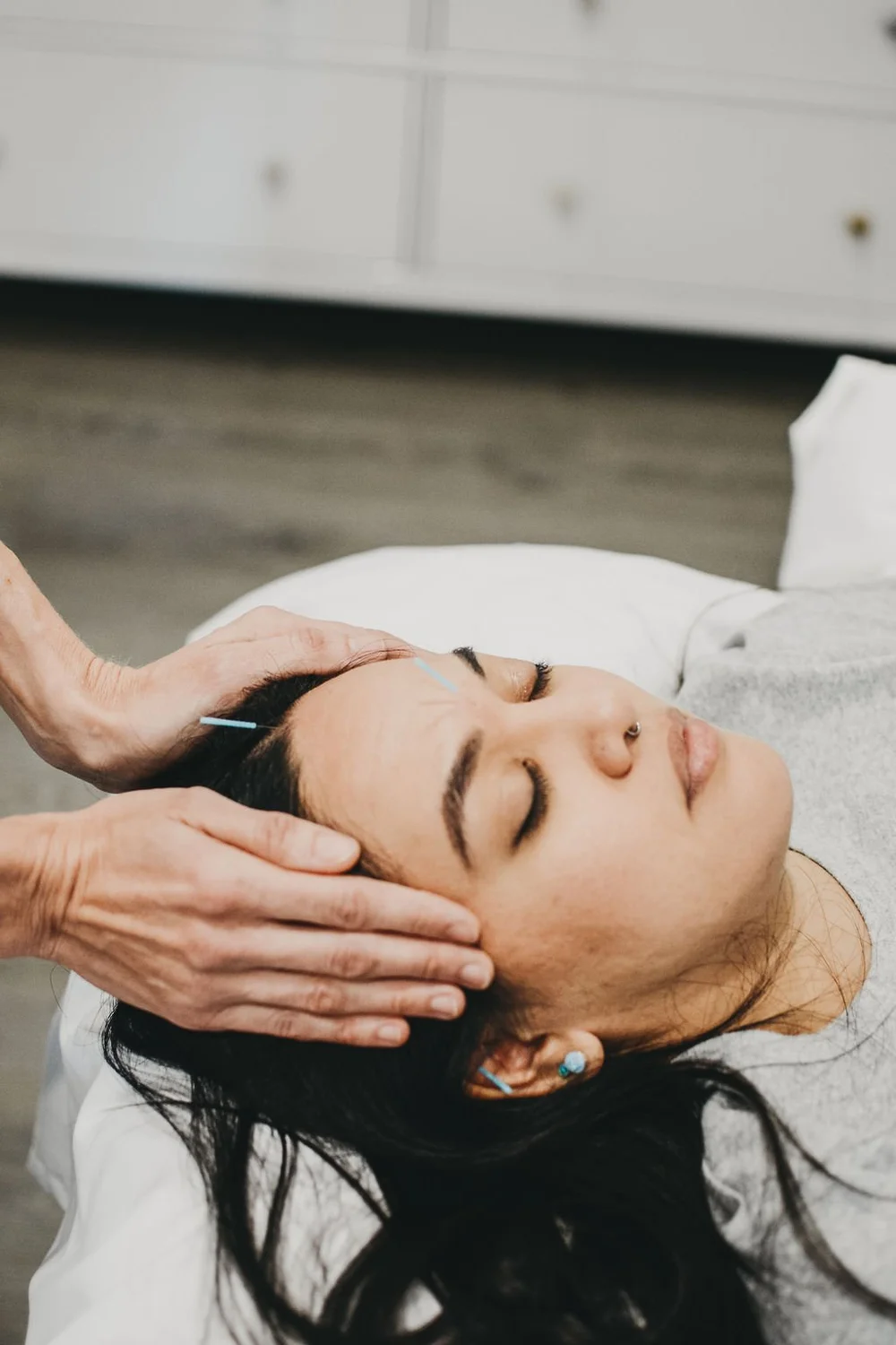 Unraveling the Knots Acupuncture's Soothing Touch on Anger Management