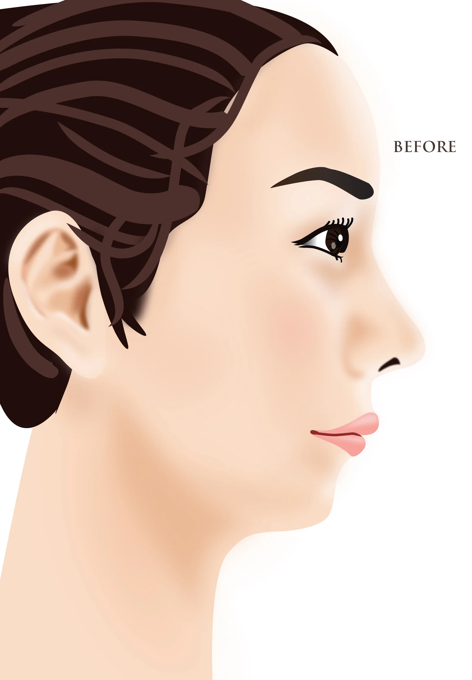 Chin Before2.jpg
