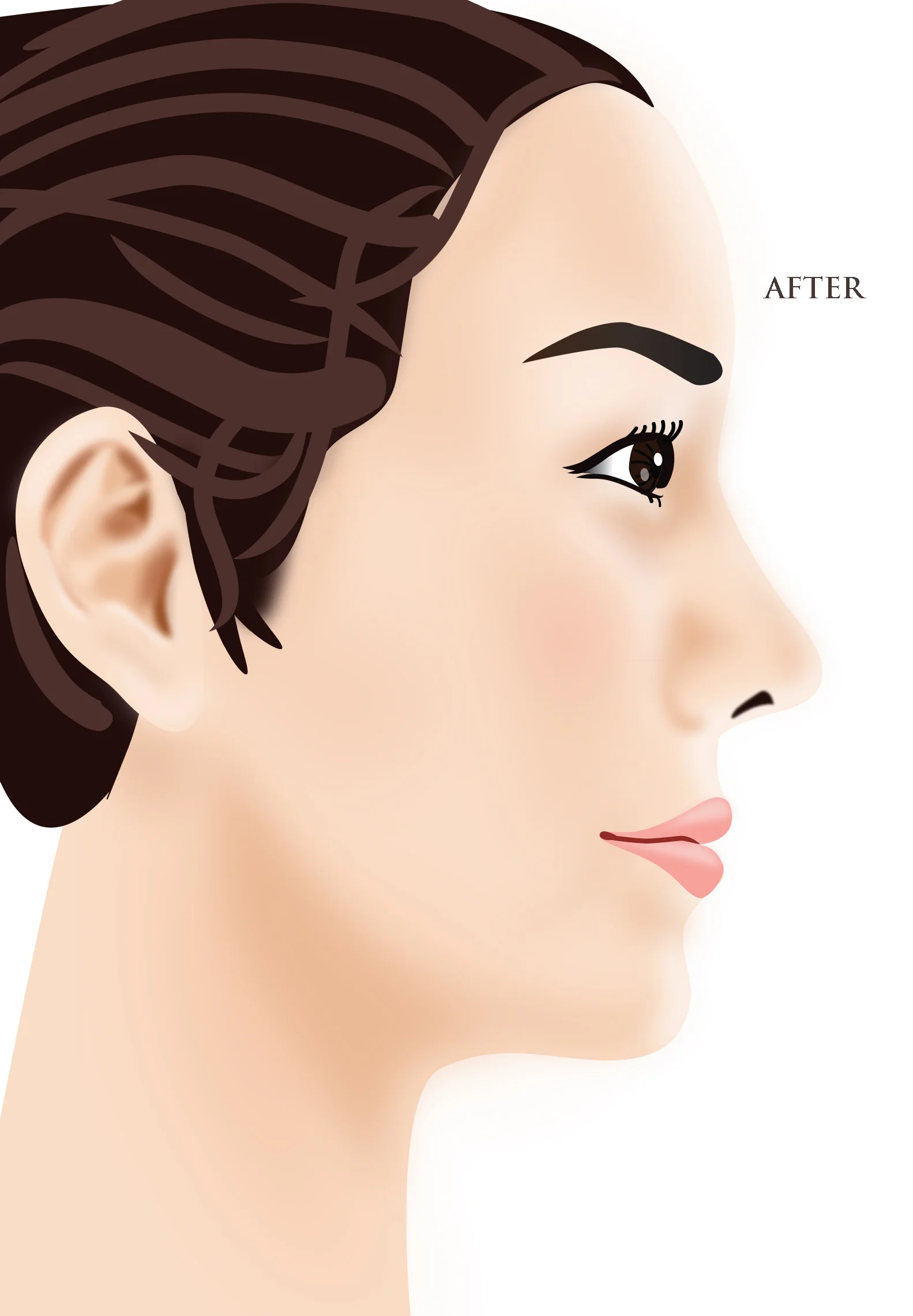 Chin After2.jpg