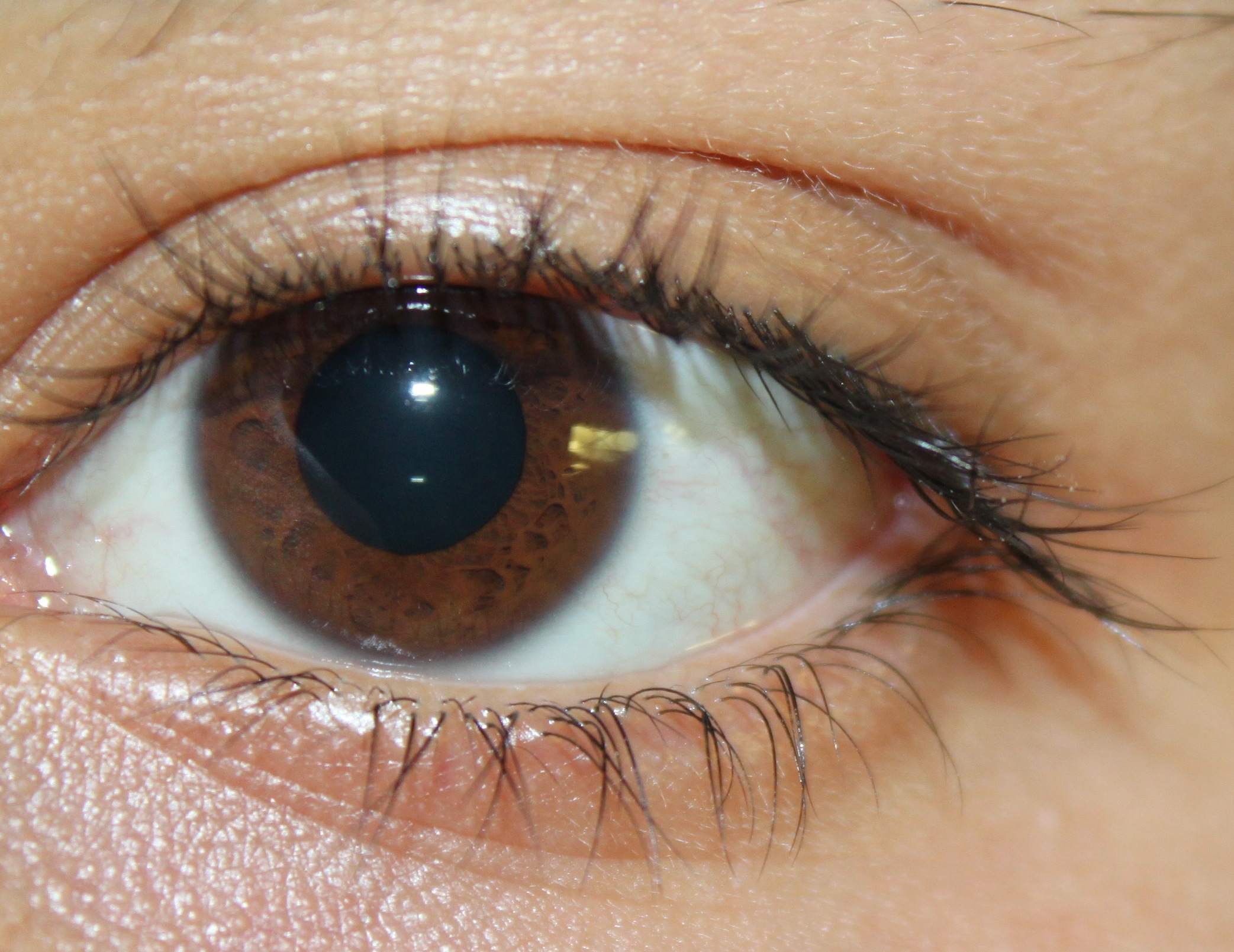 Original eye image