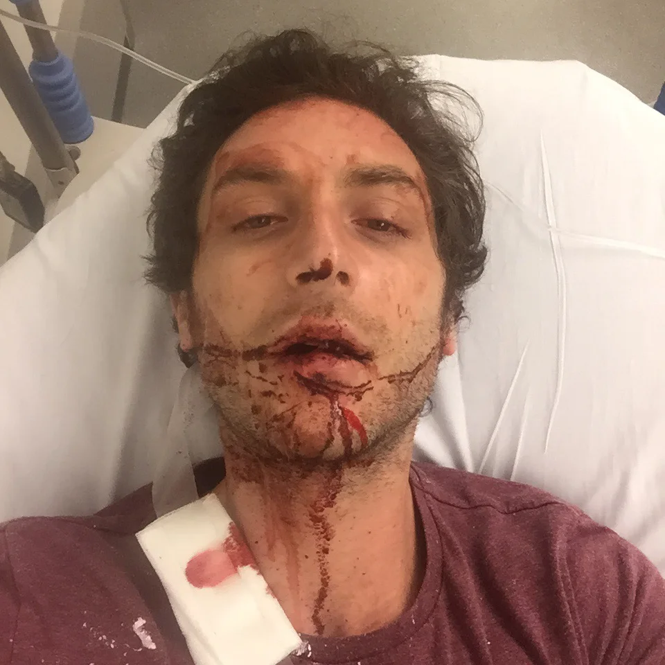 In shock on a stretcher in the emergency room
