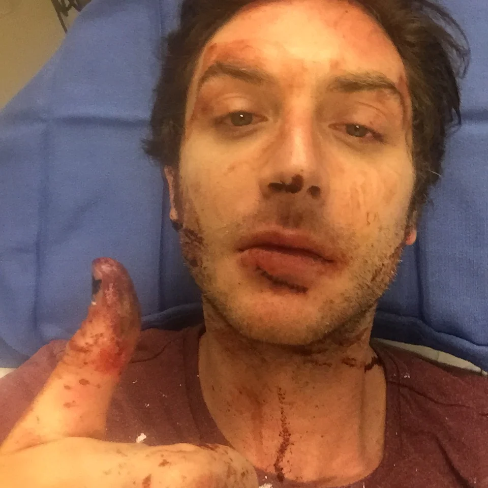 After surgery and ready for action