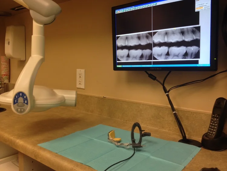 Pictured: some of the digital x-ray equipment at our office