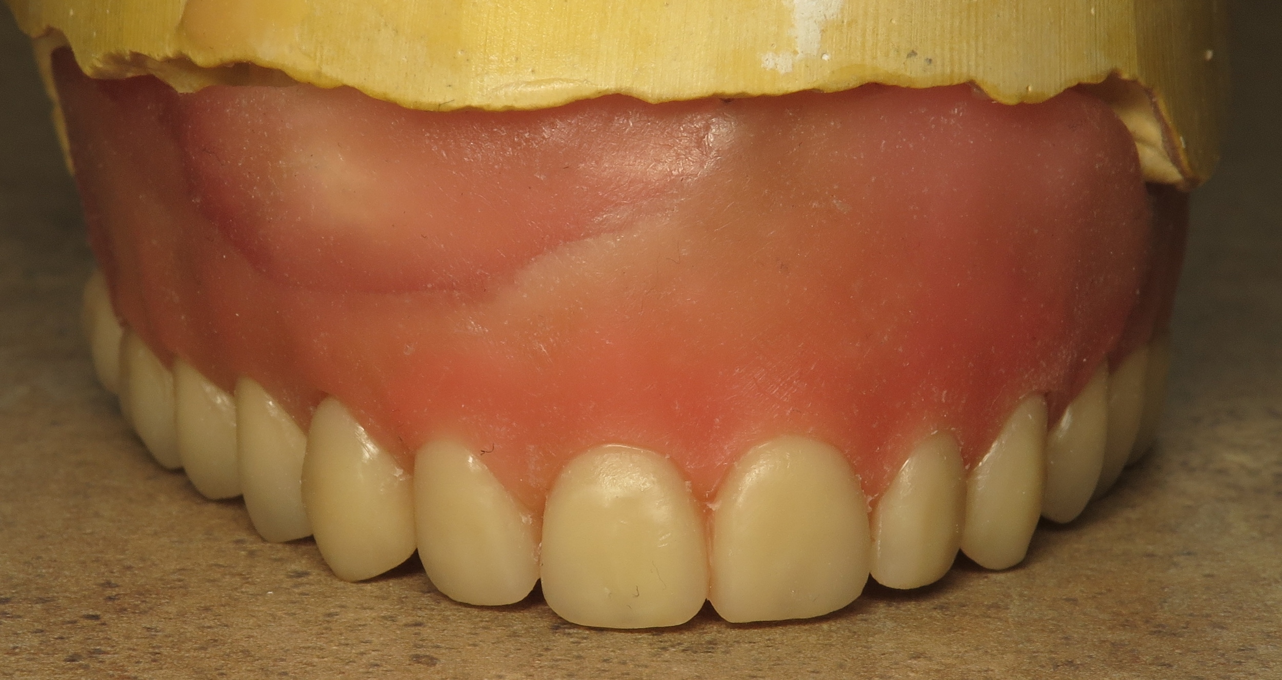 Thousand Oaks Family Dentistry - Full Upper Denture Waxed.jpg