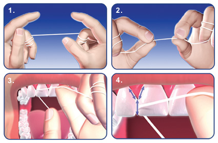 The proper way to floss. After going under the tooth contacts, make sure you thread the floss down the gums and around the teeth in an up-and-down motion. 