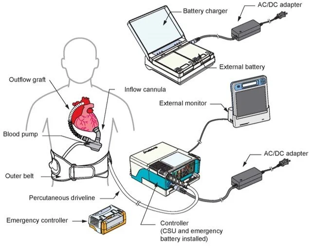 Computer Control Pulsatile Pump System Components — Rotary pump yet pulsatile