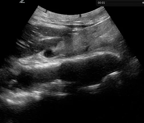 Figure C