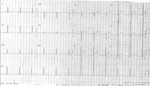 9704869-24319405-thumbnail.jpg