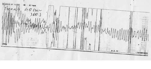 9704869-23687235-thumbnail.jpg