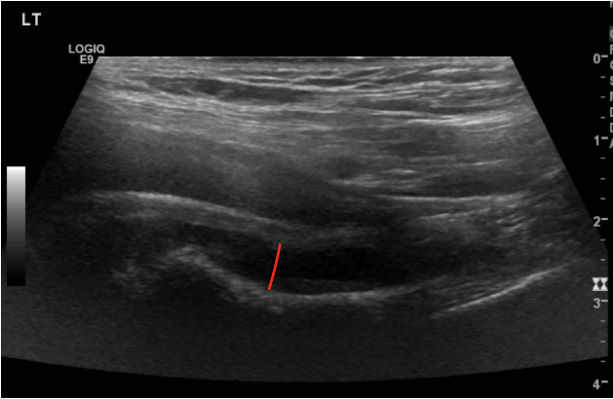 red line = 6mm
