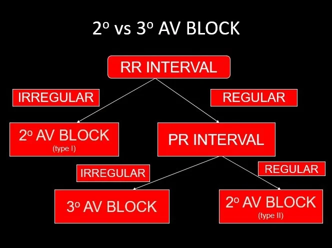 Algorithm 2nd degree vs 3rd degree AV block (1).jpg