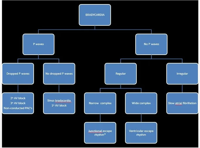 Bradycardia algorithm.jpg