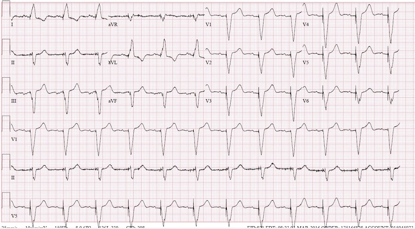 2019 7-28 previous EKG.jpg