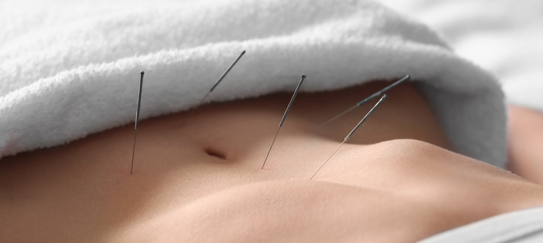 acupuncture for fertility ile ilgili gÃ¶rsel sonucu
