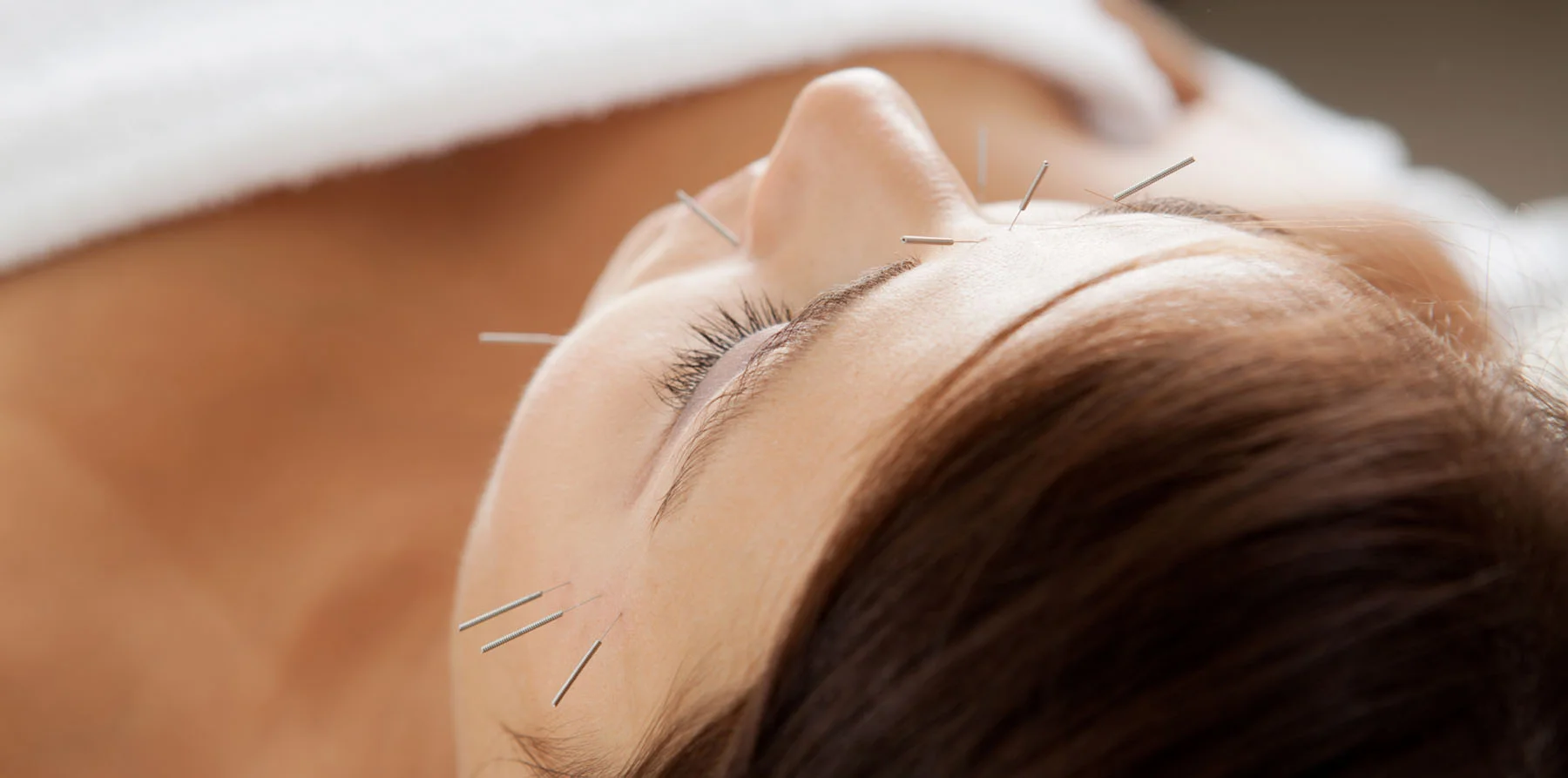 acupuncture-facial-rejuvenation.jpg