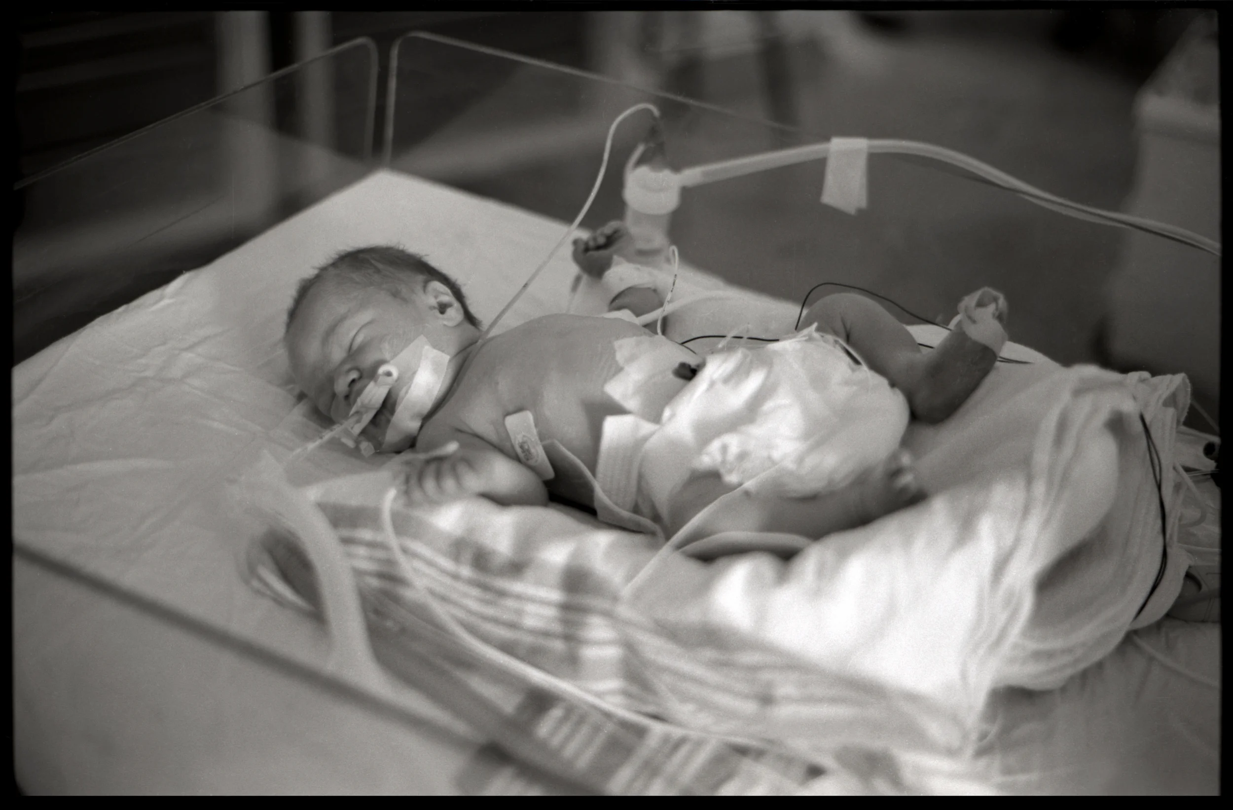 C- section gelatin silver print October 1999