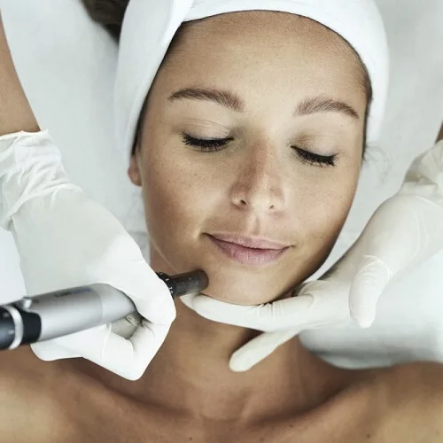 microneedling small.jpg