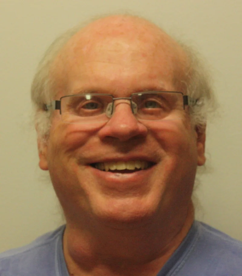 Spectacle-held Bilateral Orbital Prostheses (Copy)