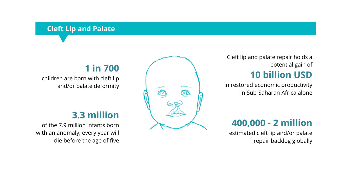 Cleft lip and palate (11).png