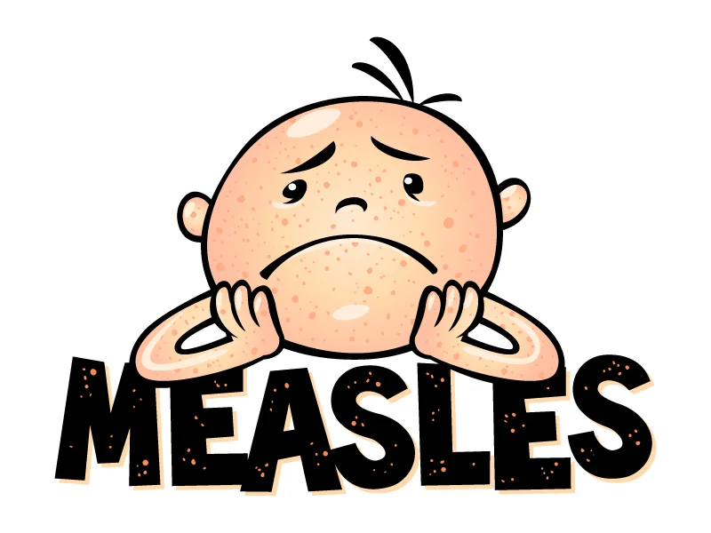 measles 1.jpg