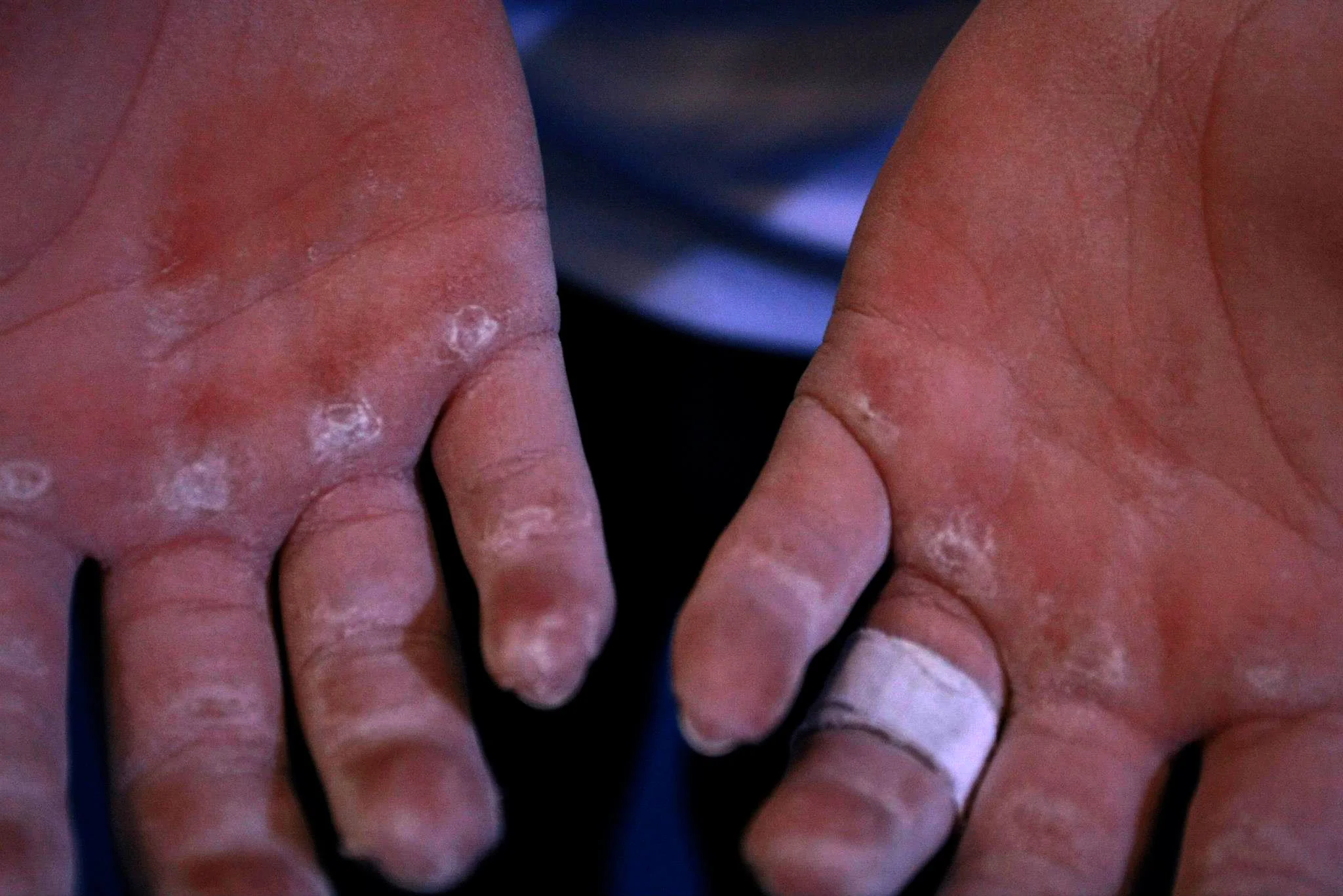 My photo, but&nbsp;not my hands.&nbsp;Close though.