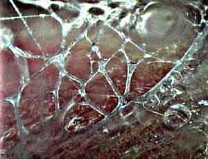 Fascia is the tough layers of fibrous, collagen-based connective tissue found throughout the entire human body. 